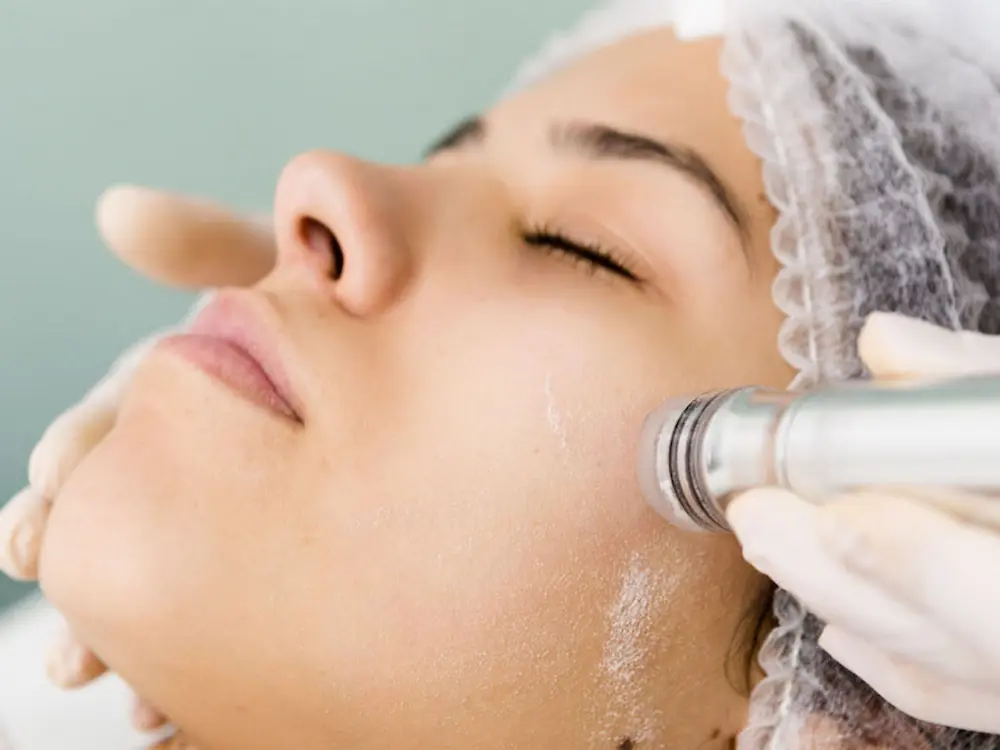 بهترین سالنهای تخصصی لایهبرداری و پاکسازی پوست